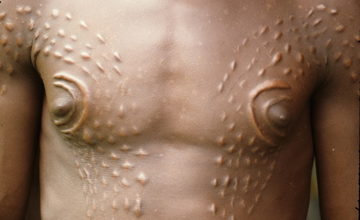 Hommes-crocodiles
